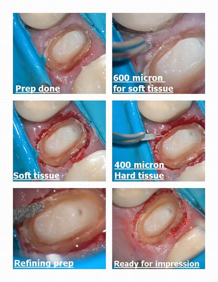 DM osseous pg 2.jpg